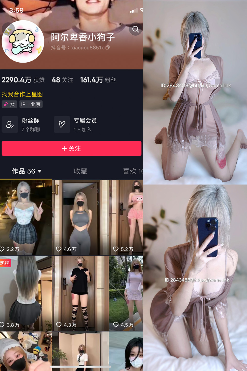 图片[1]-抖音 阿尔卑香小狗子 微密圈  NO.016期 【33P】-微密空间-全网最全抖音网红铁粉空间觅圈